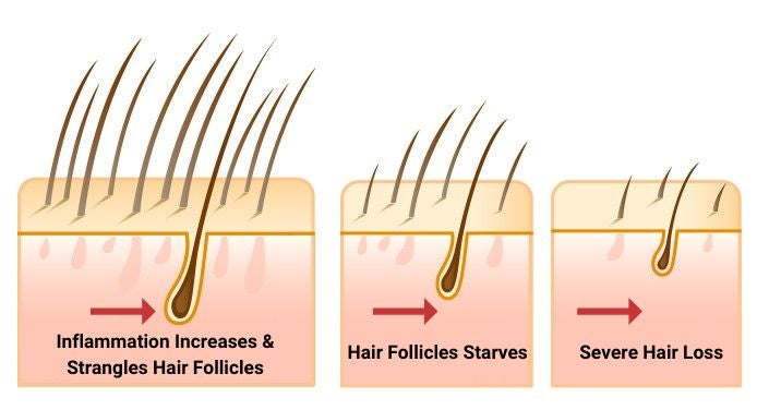 Folivé™