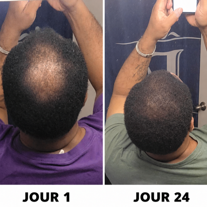 Folivé ™
