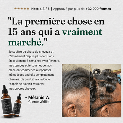 Folivé ™
