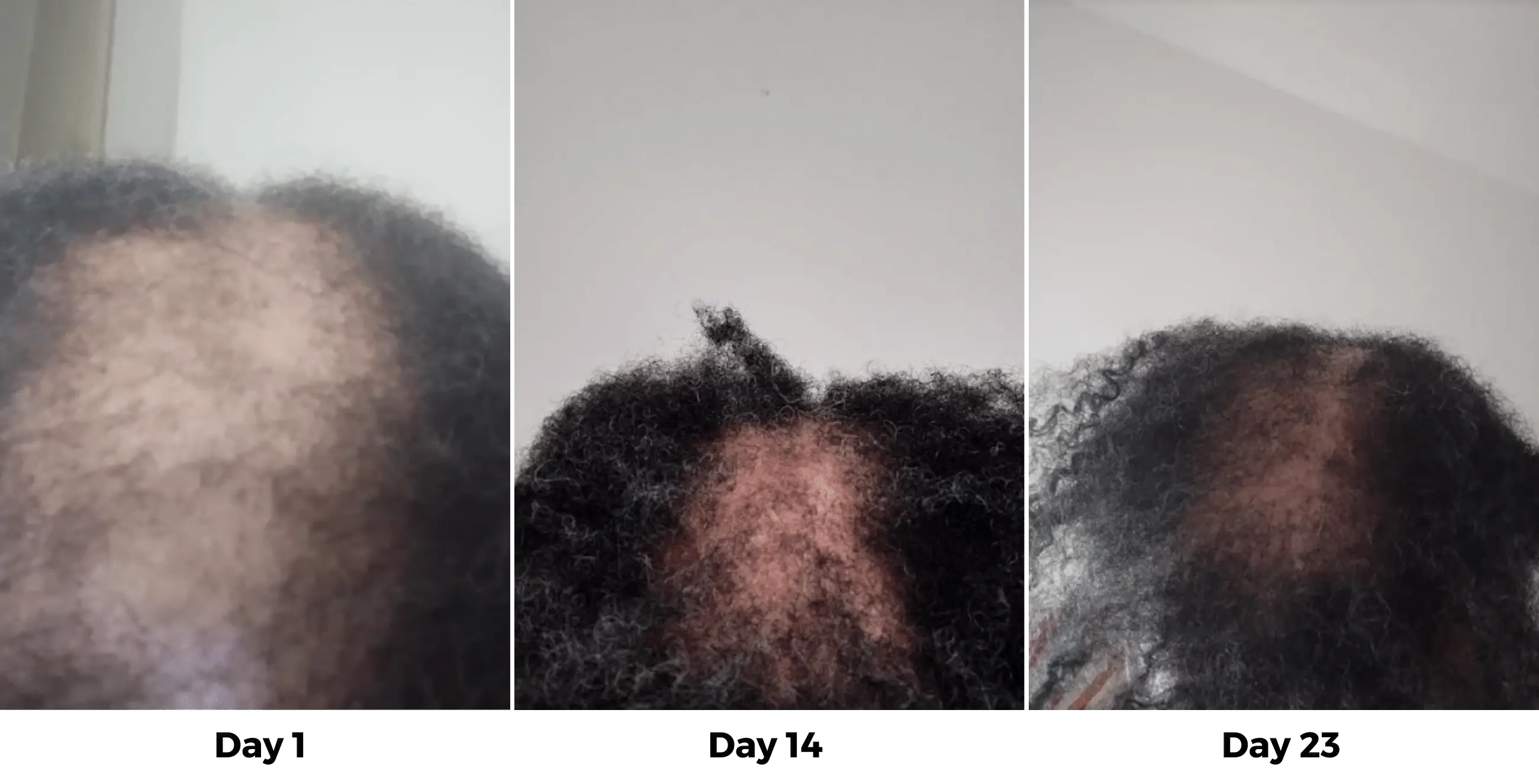 Folivé™